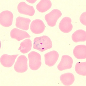 Case_515_C
