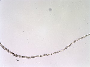 Case_518_C