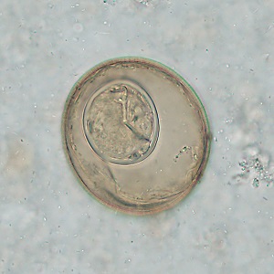 Figure B
