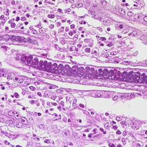 C_philippinensis_HE2.jpg
