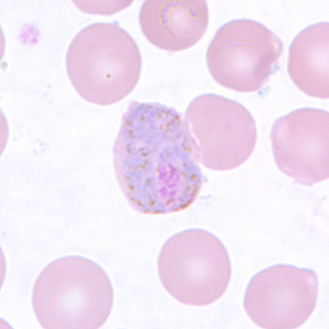 Pv_gametocyte_thinC.jpg