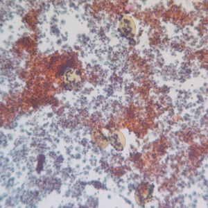 P_kellicottii_BAL100x_Prokop.jpg