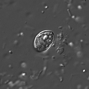 Sarcocystis_DIC1_400x.jpg