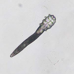 Demodex_Vidhya_A.jpg