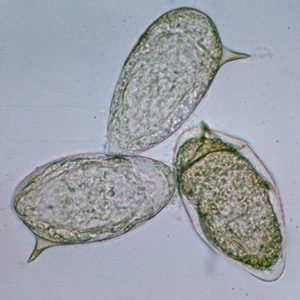 S_mansoni_egg_2X22.jpg