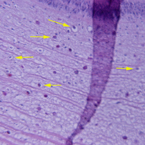 calcareous_corpuscles1.jpg