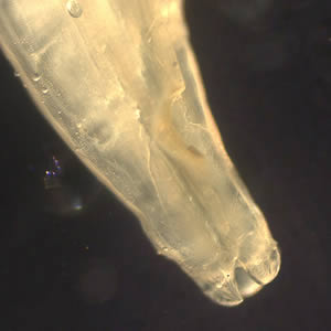 Toxocara_worm_anterior.jpg Figure B