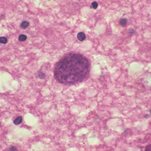 T_gondii_cyst_brain.jpg
