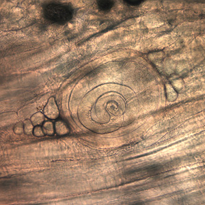 Trichinella_HBb.jpg