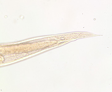 Trichostrongylus_female_posterior_200x.jpg