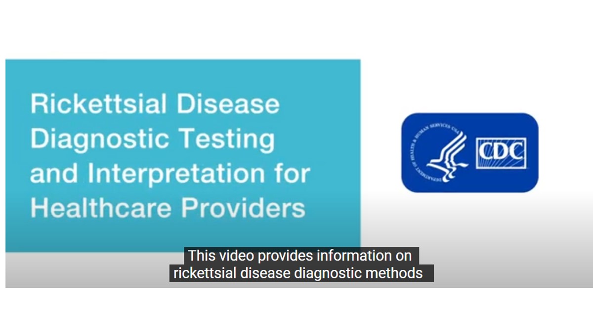 Rickettsial disease diagnostic testing and interpretation for healthcare providers.