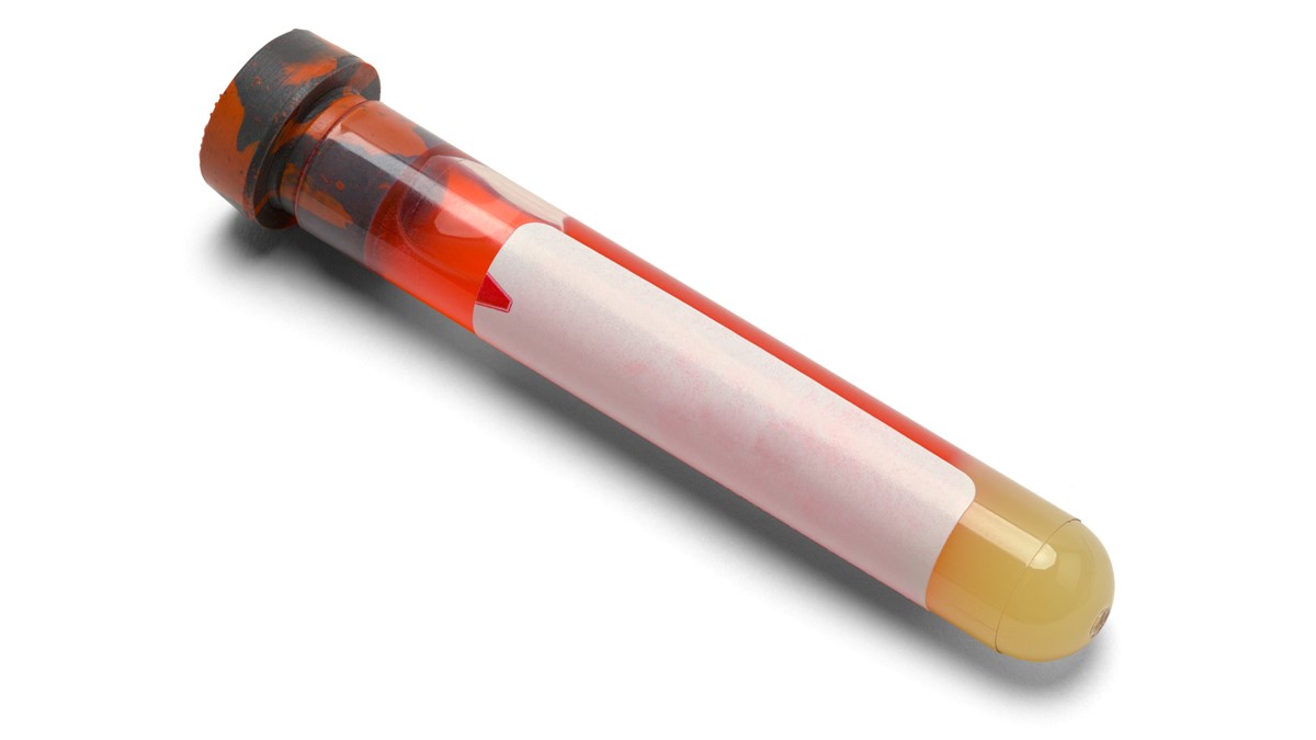 A capped testing vial of blood.