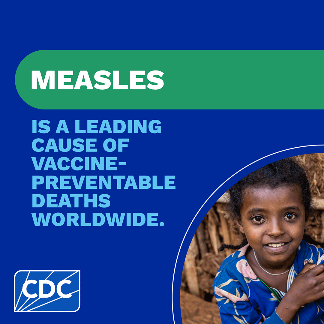 Learn about how CDC is addressing the global threat of measles.