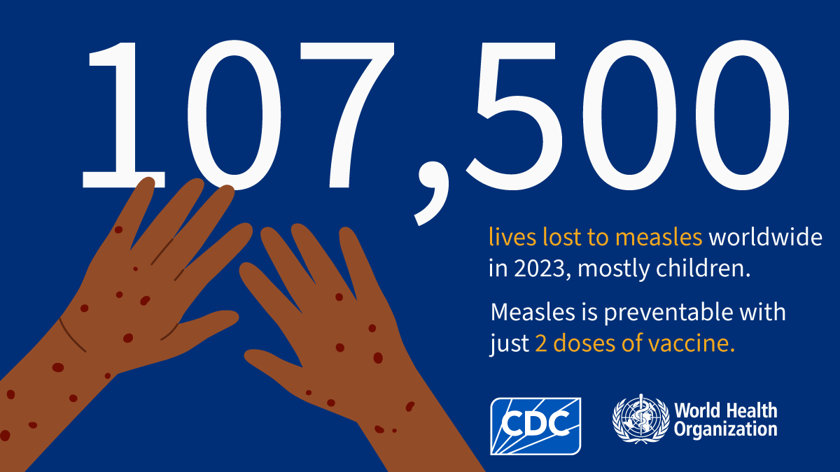 107,500 lives lost to measles worldwide in 2023, mostly children. Measles is preventable with just 2 doses of vaccine.