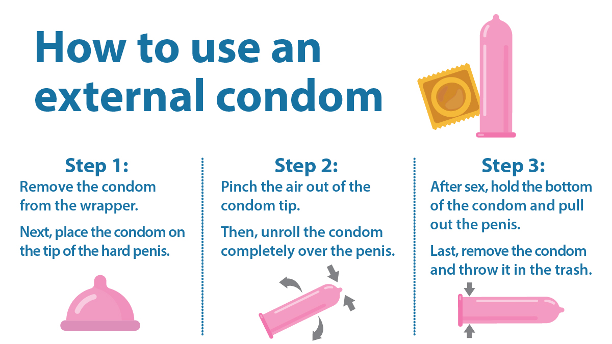 Image of how to use an external condom.