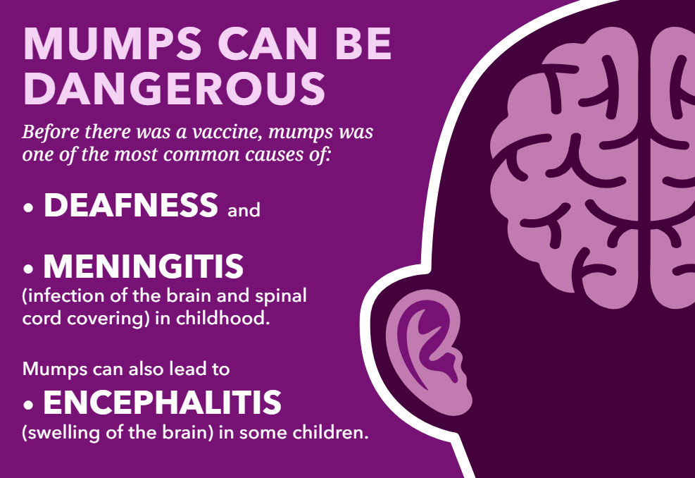 Mumps - more than just swollen glands infographic