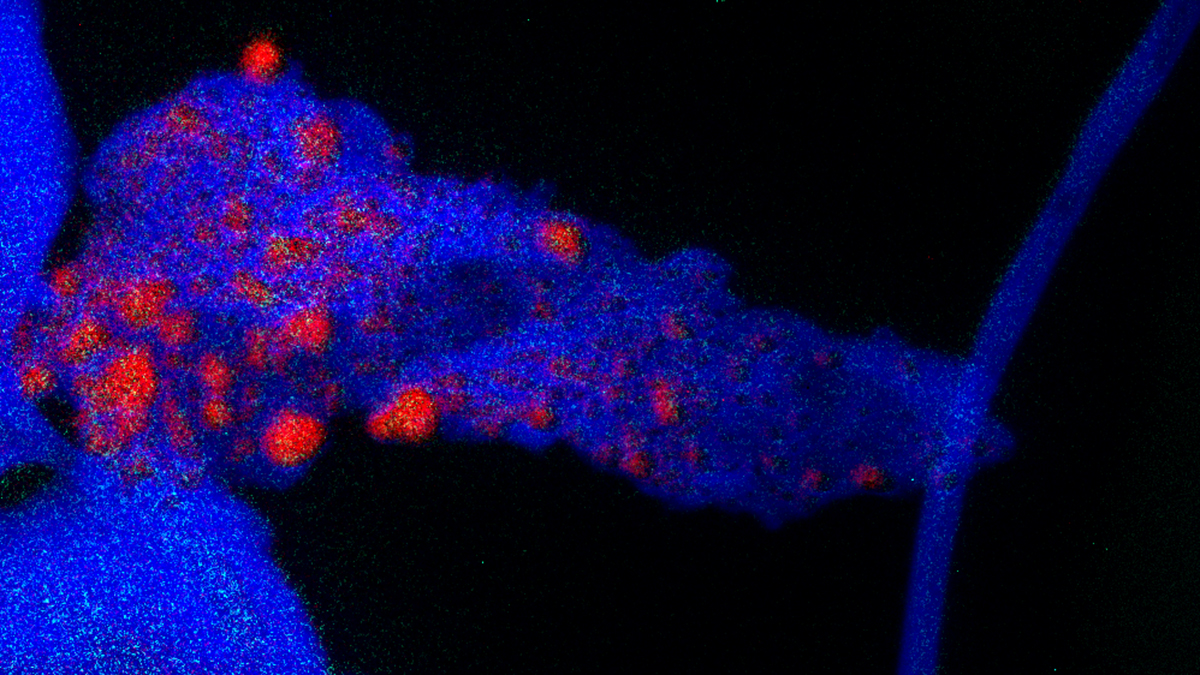 NanoCtrTN An EFTM image of the distribution nanoscale copper within cell structures of wood dust.