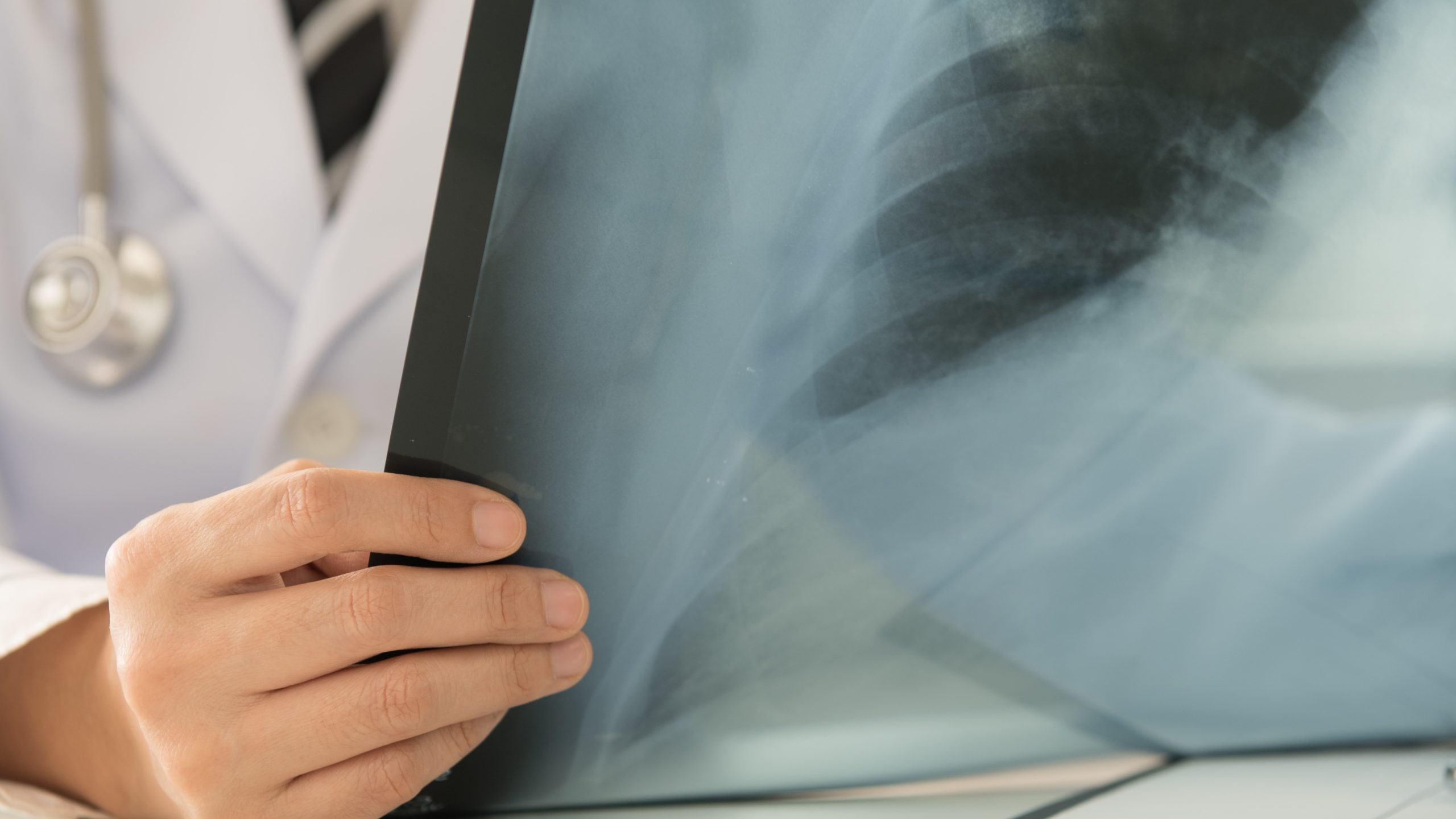 Physician reviewing an x-ray.
