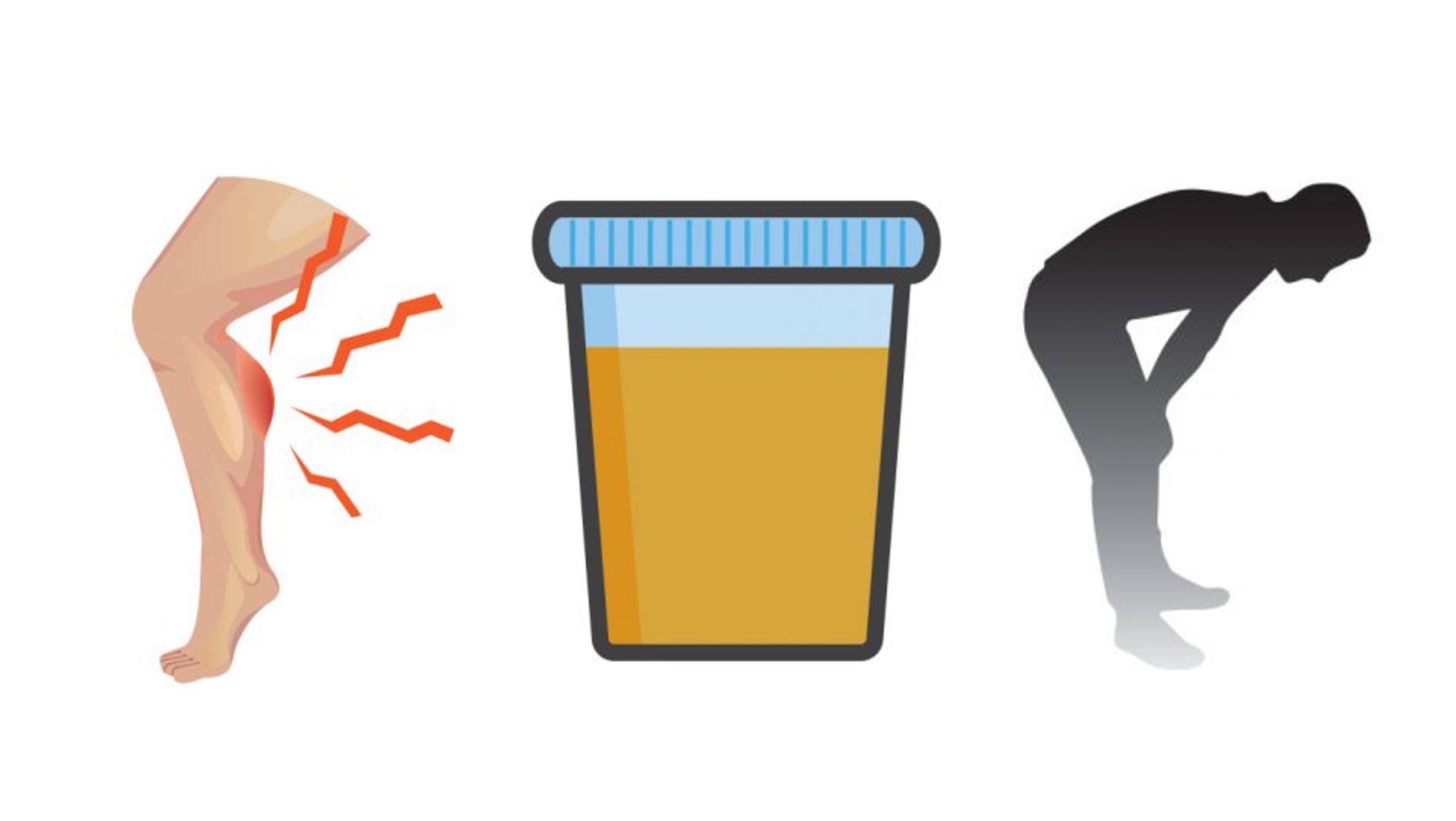 — title missing — Leg pain, dark urine, and feeling weak or tired are rhabdo symptoms.