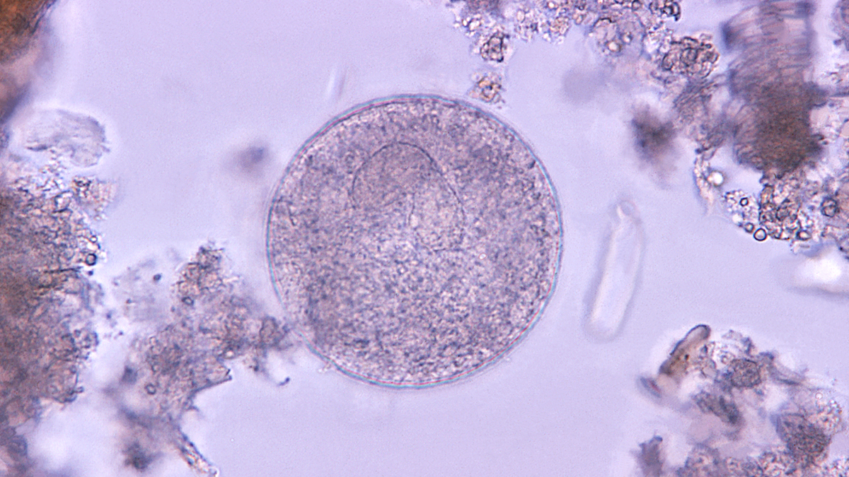 Balantidium coli Balantidium coli cyst