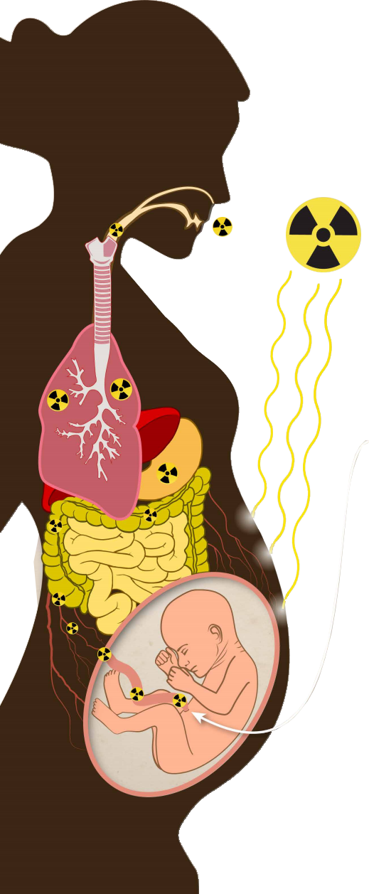 Radiation Emergencies and Pregnancy Graphic image Graphic depicting a pregnant woman and her unborn baby exposed to external radiation