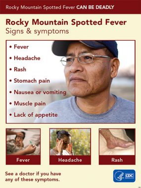 Poster for public use detailing that Rocky Mountain spotted fever can be deadly. Signs and symptoms are listed.