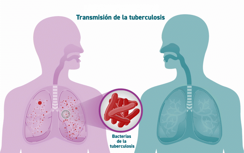 Una animación muestra los microbios de la tuberculosis propagándose de una persona a otra.